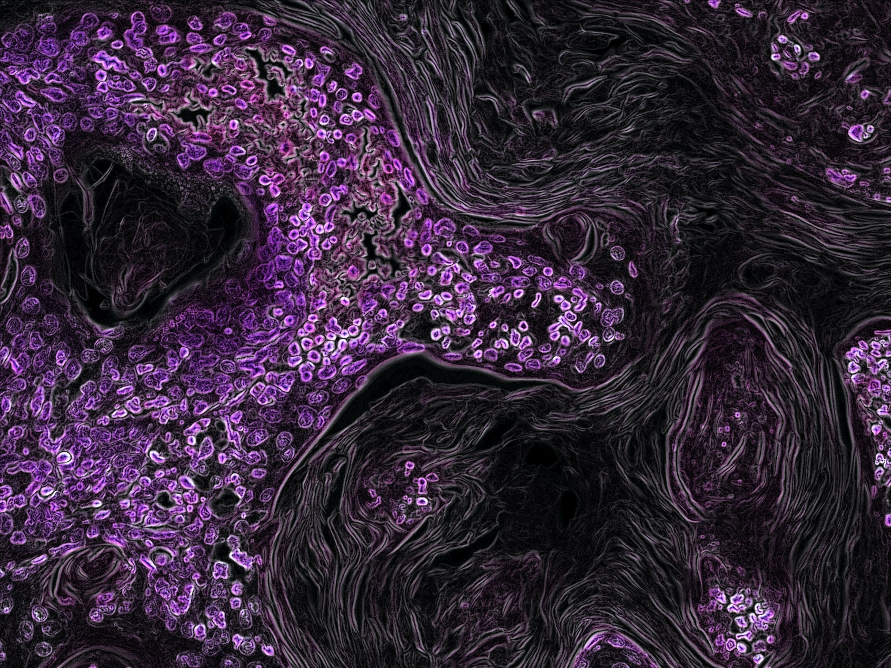 A closeup photograph of cells, dyed purple, with black swirls in between
